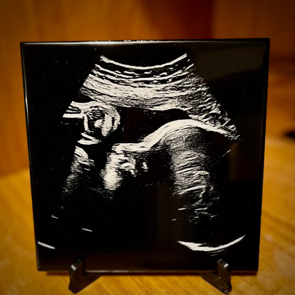 Ultrasound photo engraved on stone